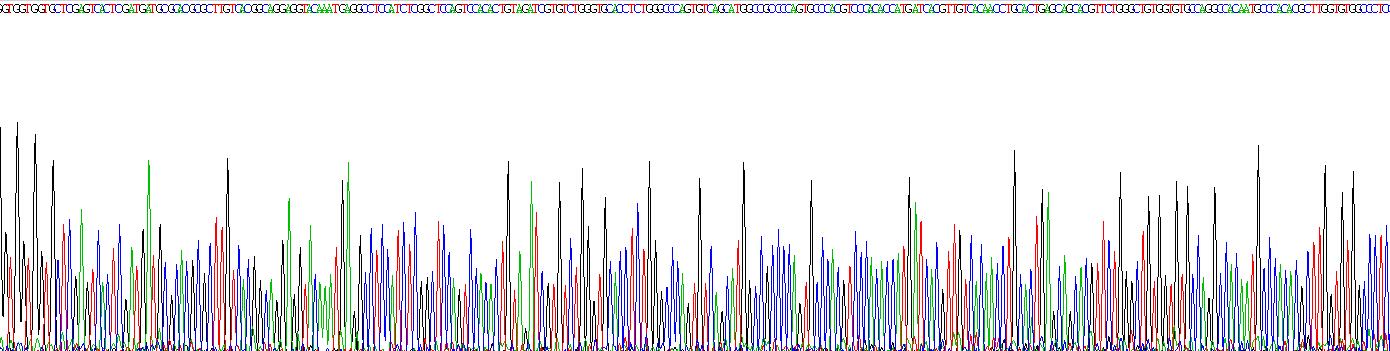冠蛋白1A(CORO1A)重組蛋白