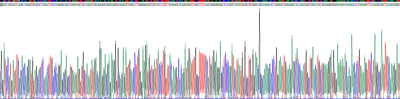 USP6氨基端样蛋白(USP6NL)重组蛋白