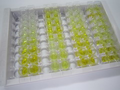 生长激素(GH)检测试剂盒(酶联免疫吸附试验法)
