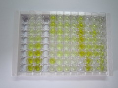 糖蛋白130(gp130)检测试剂盒(酶联免疫吸附试验法)