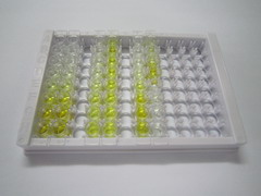 干扰素γ(IFNg)检测试剂盒(酶联免疫吸附试验法)