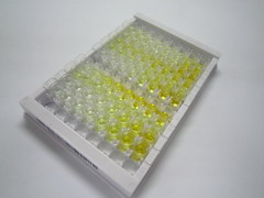 核糖核酸酶T2(RNASET2)檢測(cè)試劑盒(酶聯(lián)免疫吸附試驗(yàn)法)