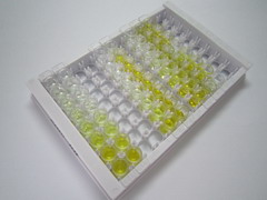 癌胚抗原(CEA)检测试剂盒(酶联免疫吸附试验法)