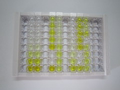 干扰素β(IFNb)检测试剂盒(酶联免疫吸附试验法)