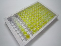 氨基端前脑钠素(NT-ProBNP)检测试剂盒(酶联免疫吸附试验法)