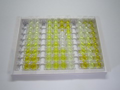 髓鞘碱性蛋白(MBP)检测试剂盒(酶联免疫吸附试验法)