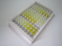 免疫球蛋白M(IgM)检测试剂盒(酶联免疫吸附试验法)