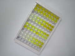 C反应蛋白(CRP)检测试剂盒(酶联免疫吸附试验法)