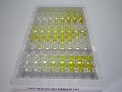 克拉拉细胞蛋白16(CC16)检测试剂盒(酶联免疫吸附试验法)