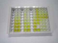 半胱氨酸蛋白酶抑制剂3(Cys-C)检测试剂盒(酶联免疫吸附试验法)