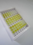 Ⅰ型前胶原氨基端原肽(PINP)检测试剂盒(酶联免疫吸附试验法)