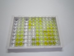 连环蛋白β1(β-catenin)检测试剂盒(酶联免疫吸附试验法)