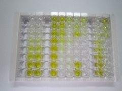 脫氧核糖核酸酶Ⅰ(DNASE1)檢測(cè)試劑盒(酶聯(lián)免疫吸附試驗(yàn)法)