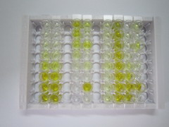 角蛋白19(CK19)检测试剂盒(酶联免疫吸附试验法)
