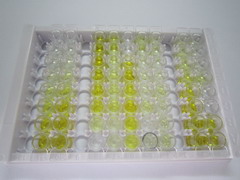 ATP结合盒转运蛋白A1(ABCA1)检测试剂盒(酶联免疫吸附试验法)