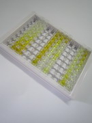 脂質(zhì)運載蛋白2(NGAL)檢測試劑盒(酶聯(lián)免疫吸附試驗法)