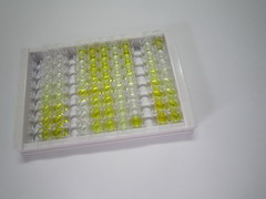 细胞色素P450家族成员21B(CYP21A2)检测试剂盒(酶联免疫吸附试验法)