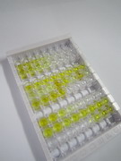 血型糖蛋白A(GYPA)检测试剂盒(酶联免疫吸附试验法)