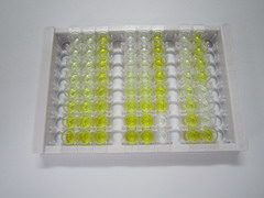 微小染色体维持缺陷蛋白2(MCM2)检测试剂盒(酶联免疫吸附试验法)
