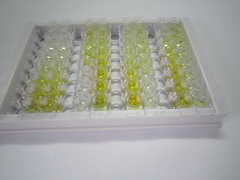谷氨酰胺转胺酶1(TGM1)检测试剂盒(酶联免疫吸附试验法)