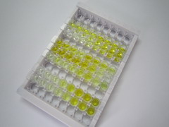S100钙结合蛋白A8(S100A8)检测试剂盒(酶联免疫吸附试验法)