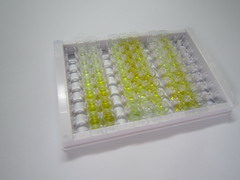 S100钙结合蛋白A9(S100A9)检测试剂盒(酶联免疫吸附试验法)