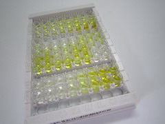 高分子量激肽原(HMWK)检测试剂盒(酶联免疫吸附试验法)