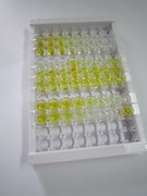 核因子κB(NFkB)检测试剂盒(酶联免疫吸附试验法)