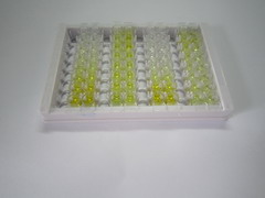 金屬硫蛋白2(MT2)檢測(cè)試劑盒(酶聯(lián)免疫吸附試驗(yàn)法)