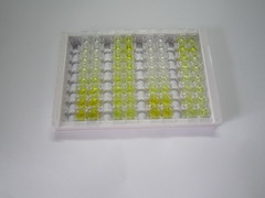 金屬硫蛋白2(MT2)檢測試劑盒(酶聯(lián)免疫吸附試驗法)