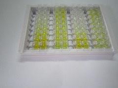 CD19分子(CD19)检测试剂盒(酶联免疫吸附试验法)