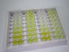 叉头框蛋白P3(FOXP3)检测试剂盒(酶联免疫吸附试验法)