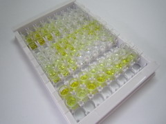 甘露聚糖结合凝集素关联丝氨酸蛋白酶1(MASP1)检测试剂盒(酶联免疫吸附试验法)