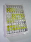 甘露聚糖结合凝集素关联丝氨酸蛋白酶1(MASP1)检测试剂盒(酶联免疫吸附试验法)