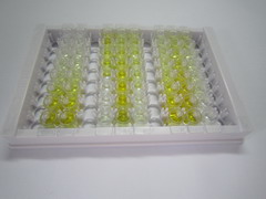 膜联蛋白A2(ANXA2)检测试剂盒(酶联免疫吸附试验法)