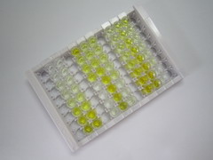 膜联蛋白A2(ANXA2)检测试剂盒(酶联免疫吸附试验法)
