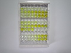 Toll样受体7(TLR7)检测试剂盒(酶联免疫吸附试验法)