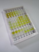 补体成分5(C5)检测试剂盒(酶联免疫吸附试验法)
