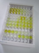 补体成分5(C5)检测试剂盒(酶联免疫吸附试验法)