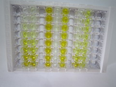 白介素8受体β(IL8Rb)检测试剂盒(酶联免疫吸附试验法)