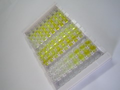 絲氨酸蛋白酶抑制劑A10(SERPINA10)檢測試劑盒(酶聯(lián)免疫吸附試驗(yàn)法)