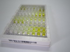 S100钙结合蛋白A4(S100A4)检测试剂盒(酶联免疫吸附试验法)