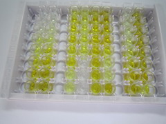 输出蛋白1(XPO1)检测试剂盒(酶联免疫吸附试验法)