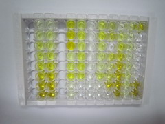 含铜胺氧化酶3(AOC3)检测试剂盒(酶联免疫吸附试验法)
