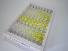 N-酰基鞘氨醇酰胺水解酶1(ASAH1)检测试剂盒(酶联免疫吸附试验法)