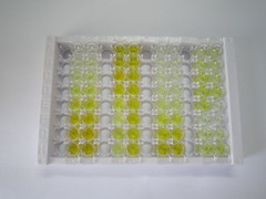 双肾上腺皮质激素(DCX)检测试剂盒(酶联免疫吸附试验法)