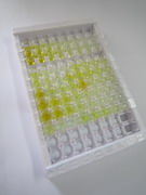 吻素1(KISS1)检测试剂盒(酶联免疫吸附试验法)