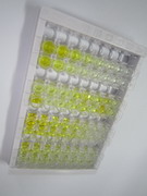 微精蛋白β(MSMb)检测试剂盒(酶联免疫吸附试验法)
