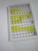 非受体酪氨酸激酶2(TNK2)检测试剂盒(酶联免疫吸附试验法)