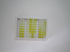 可溶性胸苷激酶1(TK1)检测试剂盒(酶联免疫吸附试验法)